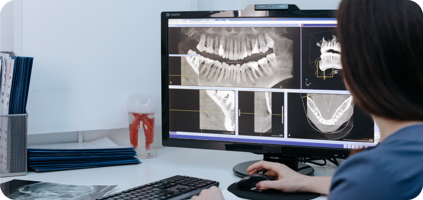 Radiology report-guided representation learning pipeline